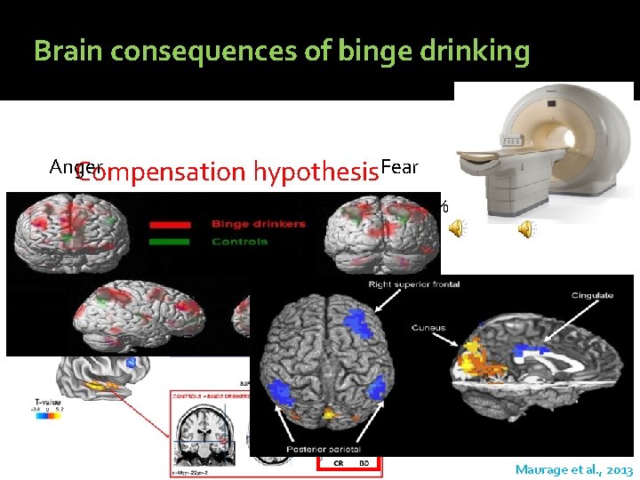 Brain consequences of binge drinking Anger Compensation hypothesis. Fear %Fear 5% 20% 35% 50%