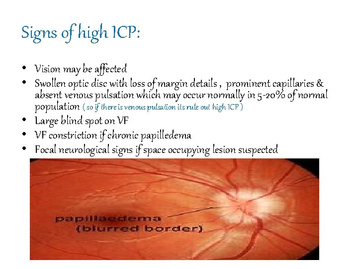 Signs of high ICP: • Vision may be affected • Swollen optic disc with