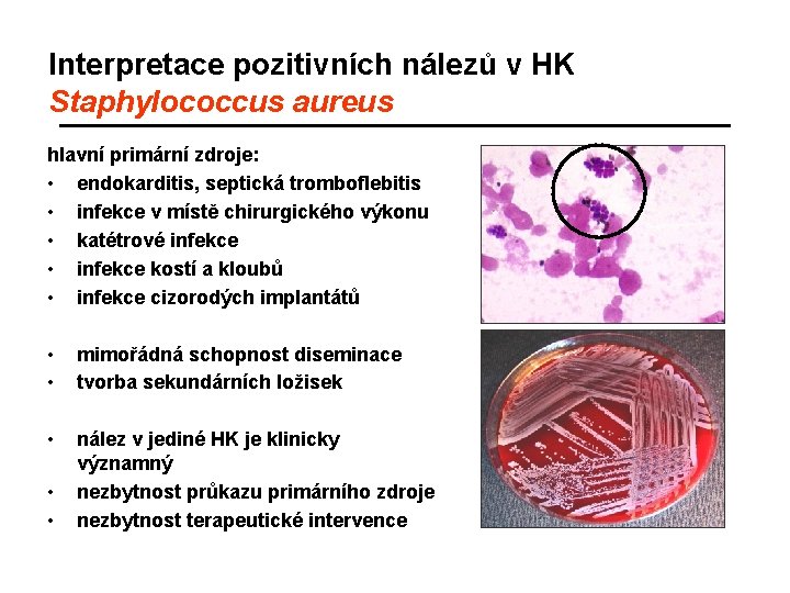 Interpretace pozitivních nálezů v HK Staphylococcus aureus hlavní primární zdroje: • endokarditis, septická tromboflebitis