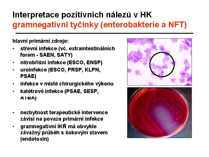 Interpretace pozitivních nálezů v HK gramnegativní tyčinky (enterobakterie a NFT) hlavní primární zdroje: •