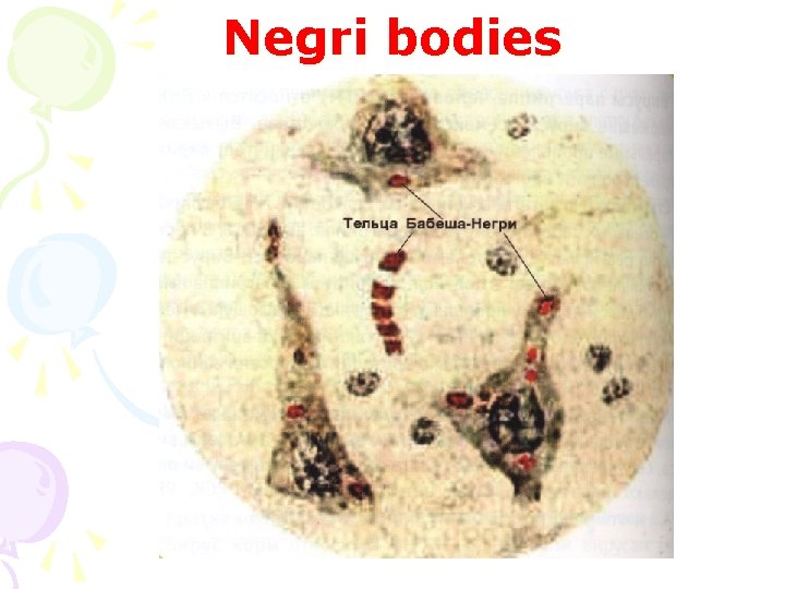 Negri bodies 