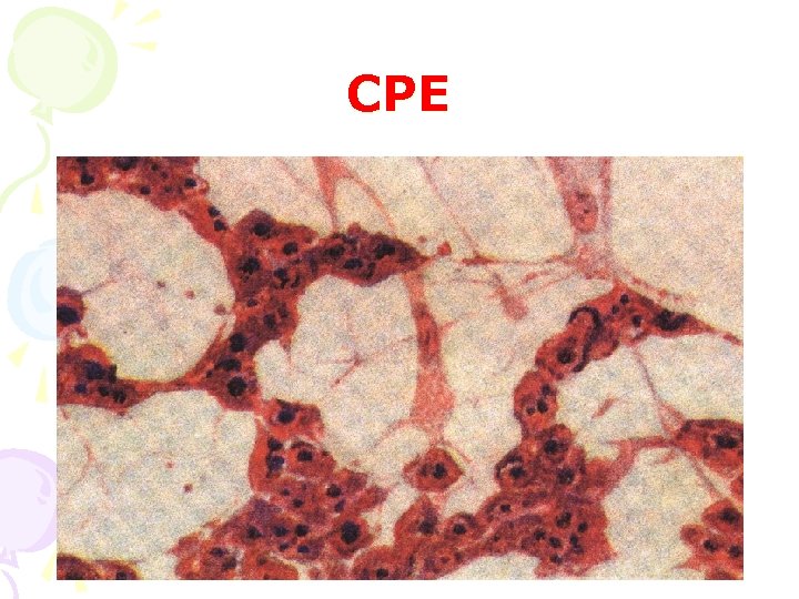CPE 