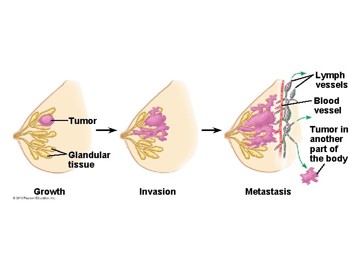 Lymph vessels Blood vessel Tumor in another part of the body Glandular tissue Growth