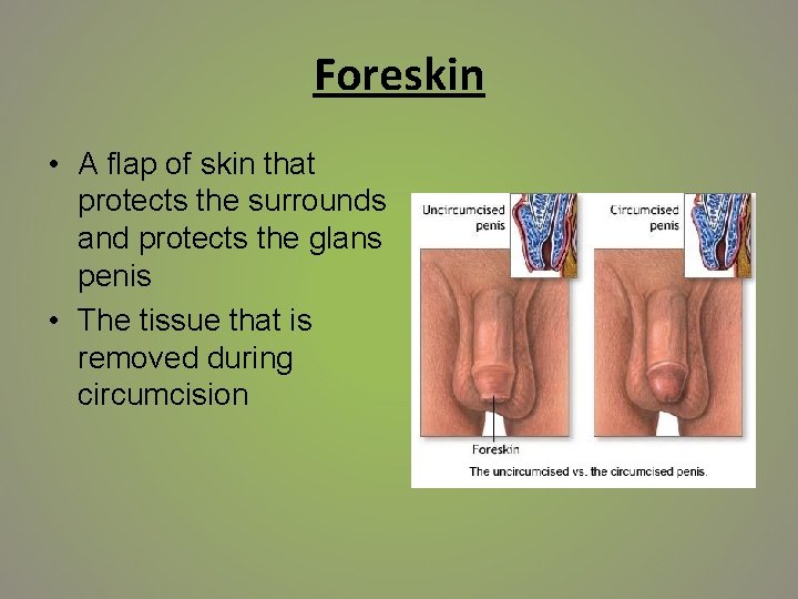 Foreskin • A flap of skin that protects the surrounds and protects the glans