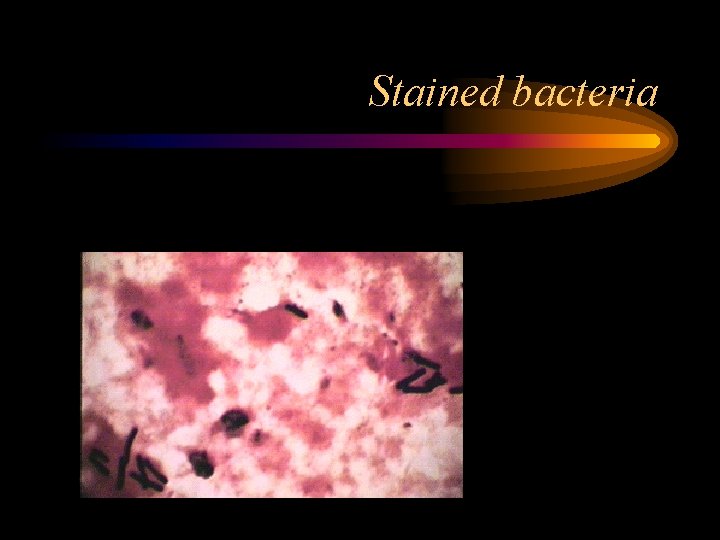 Stained bacteria 