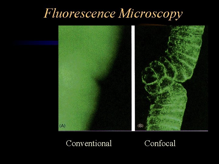 Fluorescence Microscopy Conventional Confocal 