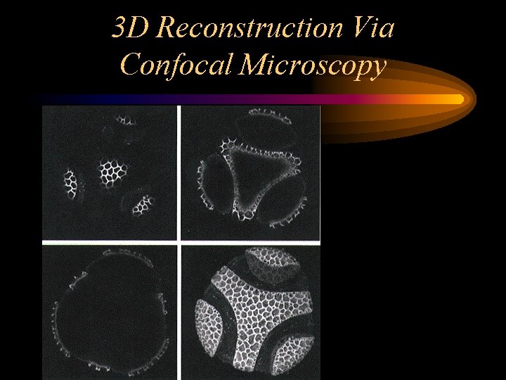 3 D Reconstruction Via Confocal Microscopy 