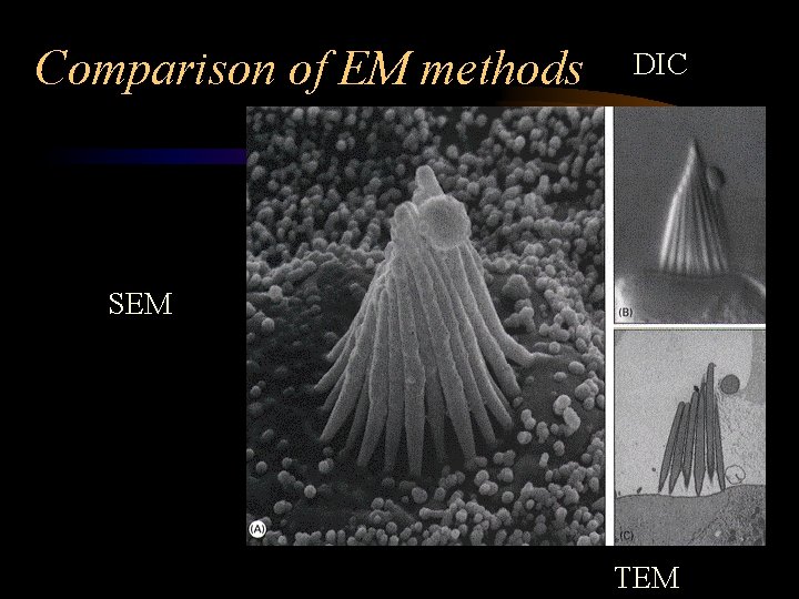 Comparison of EM methods DIC SEM TEM 