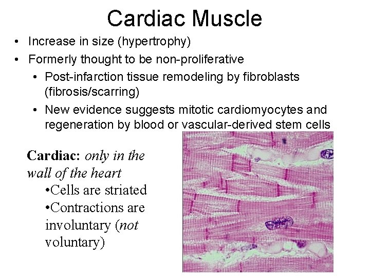 Cardiac Muscle • Increase in size (hypertrophy) • Formerly thought to be non-proliferative •