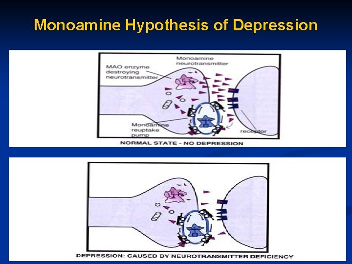 Monoamine Hypothesis of Depression 