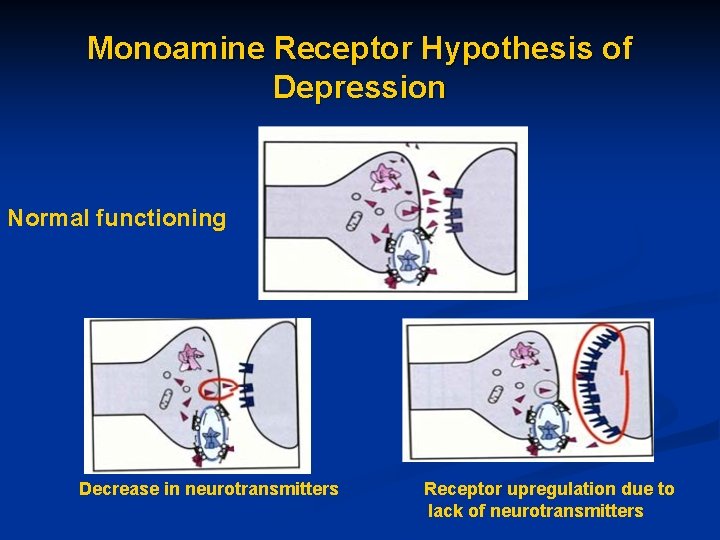 Monoamine Receptor Hypothesis of Depression Normal functioning Decrease in neurotransmitters Receptor upregulation due to