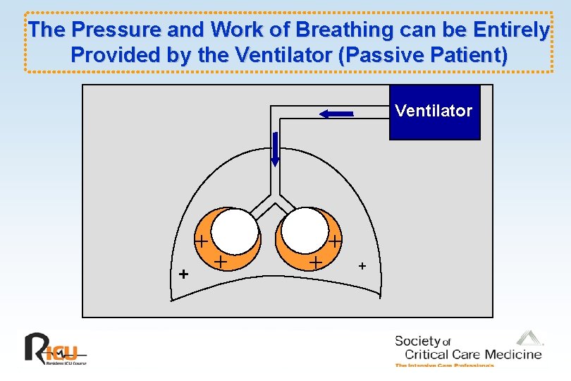 The Pressure and Work of Breathing can be Entirely Provided by the Ventilator (Passive