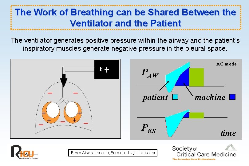 The Work of Breathing can be Shared Between the Ventilator and the Patient The