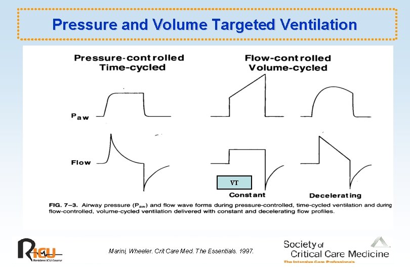 Pressure and Volume Targeted Ventilation VT Marini, Wheeler. Crit Care Med. The Essentials. 1997.