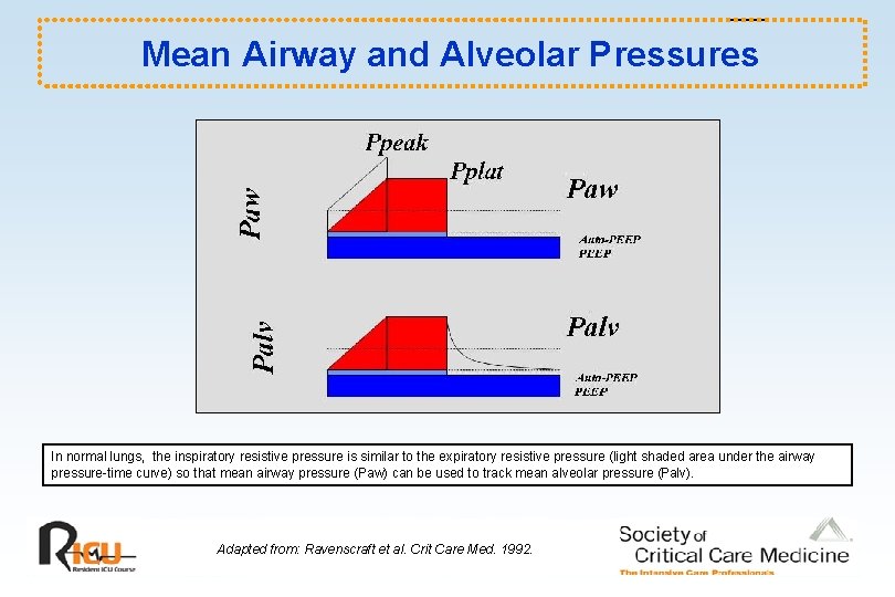 Mean Airway and Alveolar Pressures In normal lungs, the inspiratory resistive pressure is similar