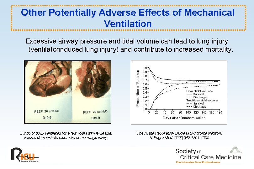 Other Potentially Adverse Effects of Mechanical Ventilation Excessive airway pressure and tidal volume can