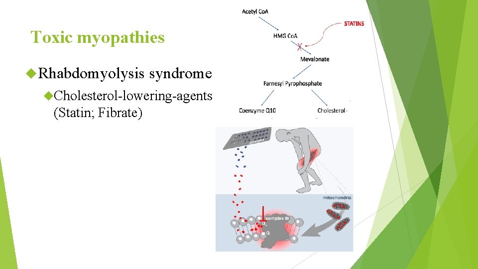 Toxic myopathies Rhabdomyolysis syndrome Cholesterol-lowering-agents (Statin; Fibrate) 