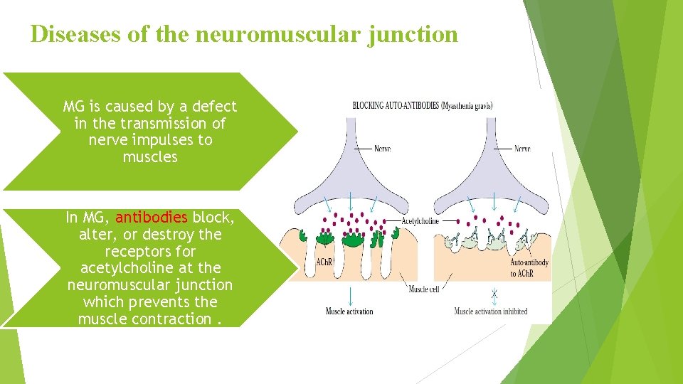 Diseases of the neuromuscular junction MG is caused by a defect in the transmission