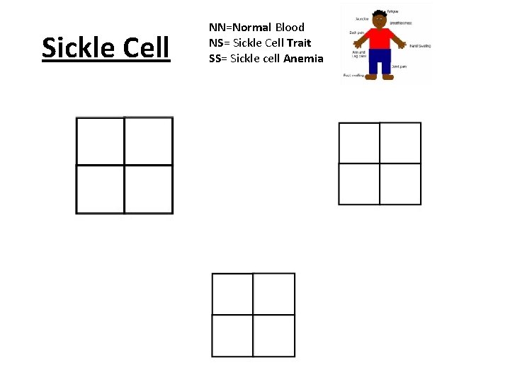 Sickle Cell NN=Normal Blood NS= Sickle Cell Trait SS= Sickle cell Anemia 