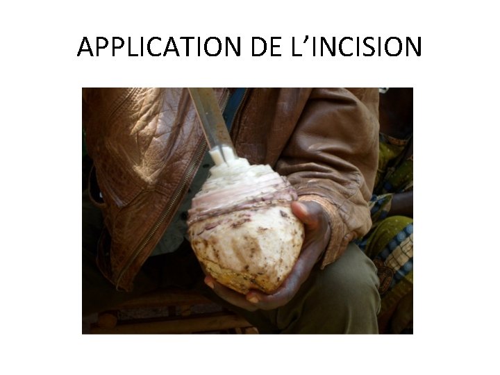 APPLICATION DE L’INCISION 