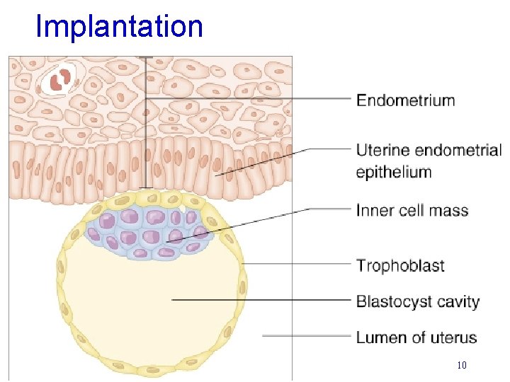 Implantation 10 