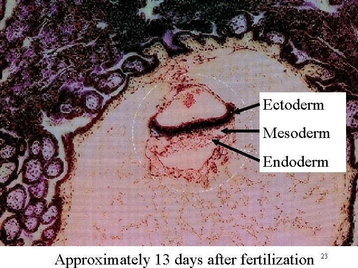 Ectoderm Mesoderm Endoderm Approximately 13 days after fertilization 23 