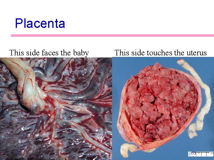 Placenta This side faces the baby This side touches the uterus 33 