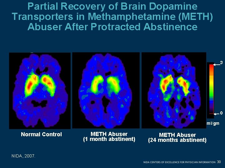 Partial Recovery of Brain Dopamine Transporters in Methamphetamine (METH) Abuser After Protracted Abstinence 3