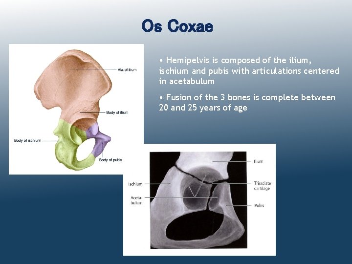 Os Coxae • Hemipelvis is composed of the ilium, ischium and pubis with articulations