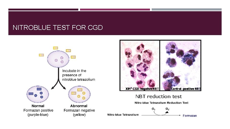 NITROBLUE TEST FOR CGD 