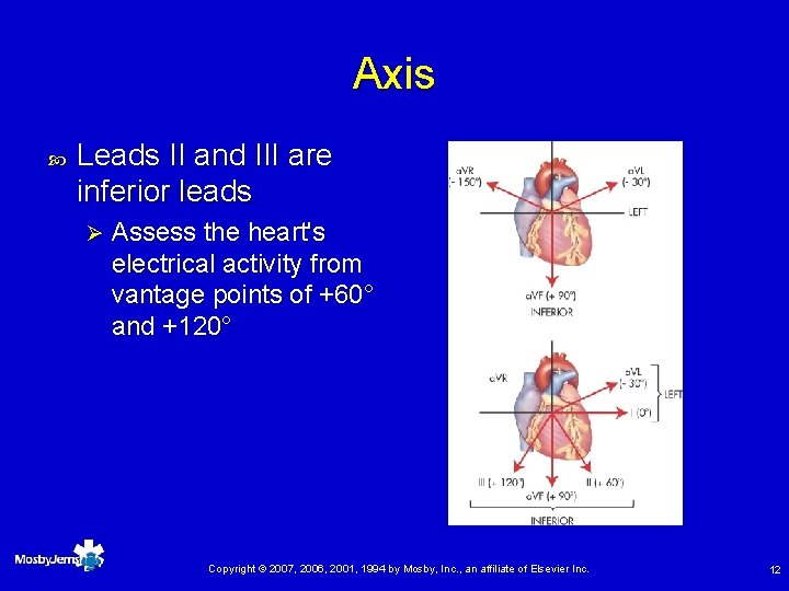 Axis Leads II and III are inferior leads Ø Assess the heart's electrical activity