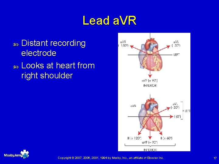 Lead a. VR Distant recording electrode Looks at heart from right shoulder Copyright ©