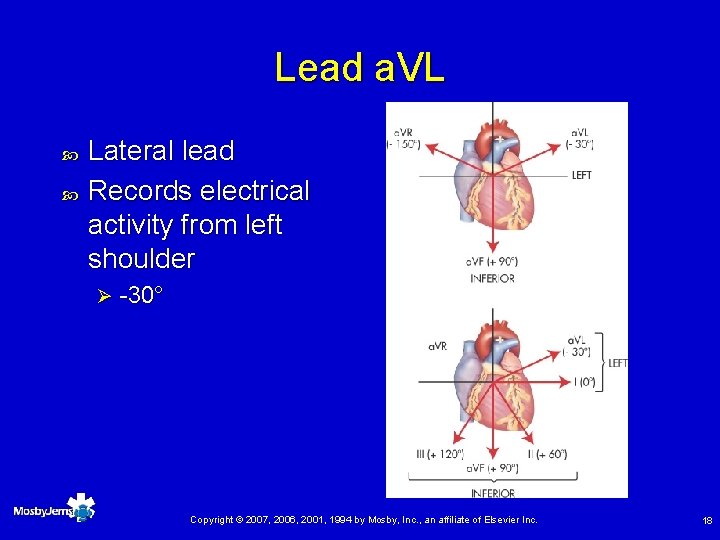 Lead a. VL Lateral lead Records electrical activity from left shoulder Ø -30° Copyright