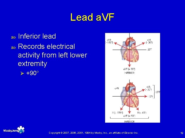 Lead a. VF Inferior lead Records electrical activity from left lower extremity Ø +90°