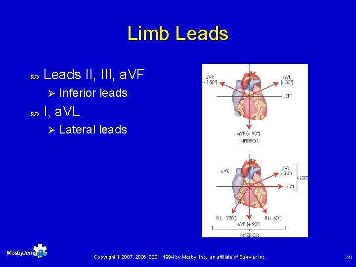 Limb Leads II, III, a. VF Ø Inferior leads I, a. VL Ø Lateral