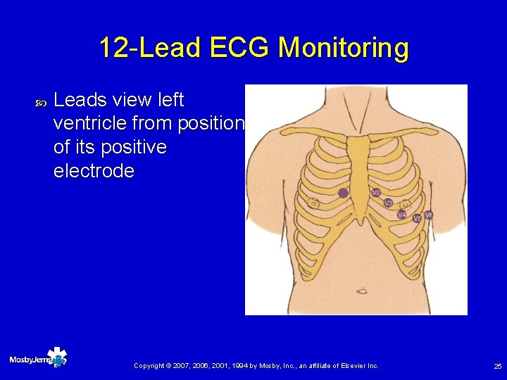 12 -Lead ECG Monitoring Leads view left ventricle from position of its positive electrode