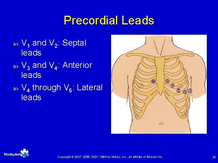 Precordial Leads V 1 and V 2: Septal leads V 3 and V 4: