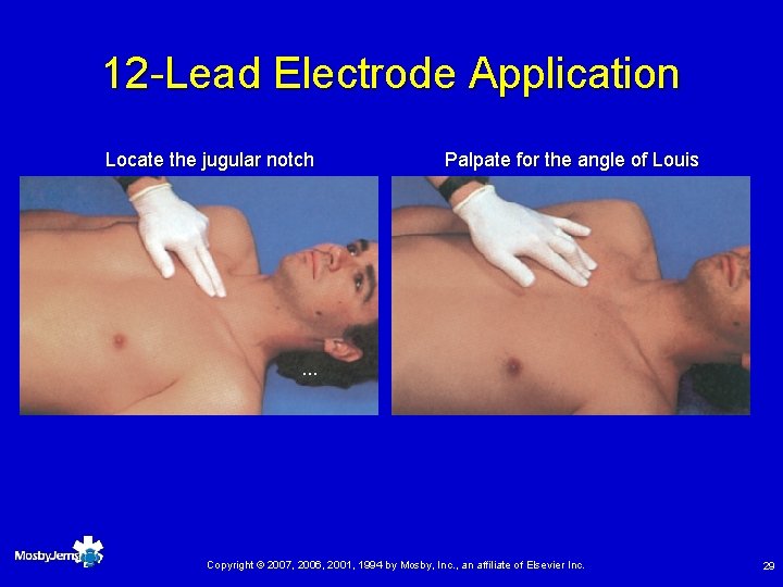 12 -Lead Electrode Application Locate the jugular notch Palpate for the angle of Louis