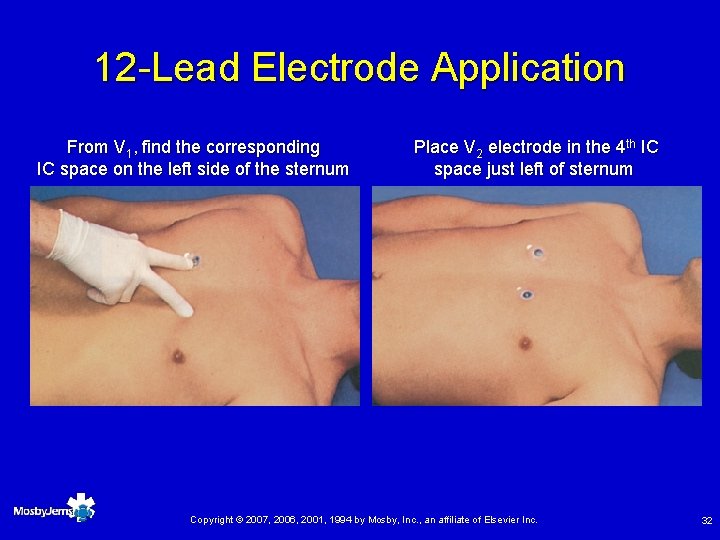 12 -Lead Electrode Application From V 1, find the corresponding IC space on the