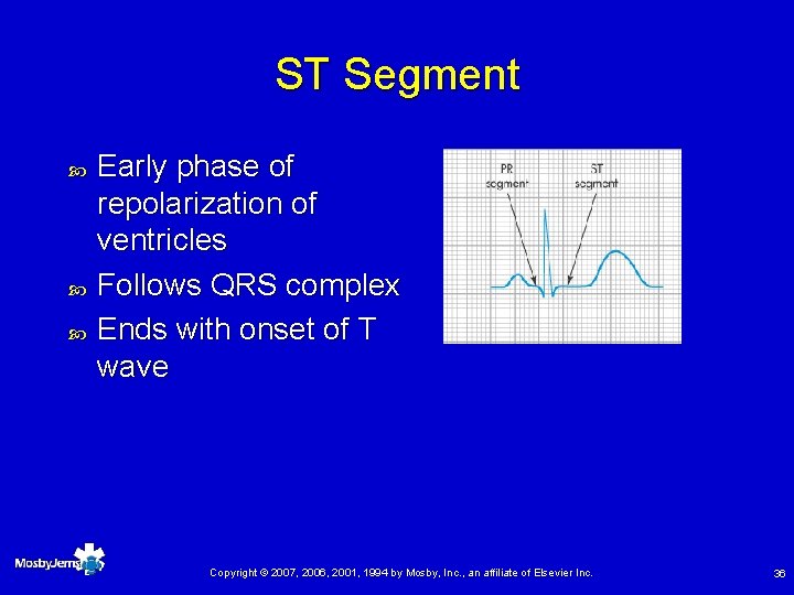 ST Segment Early phase of repolarization of ventricles Follows QRS complex Ends with onset
