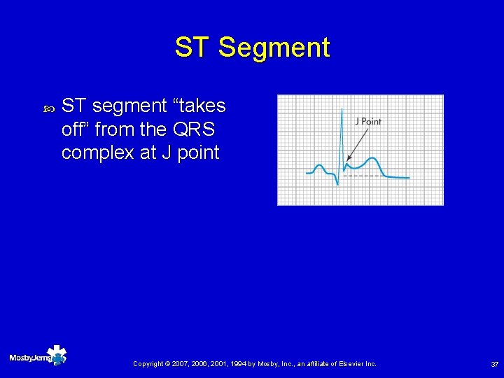 ST Segment ST segment “takes off” from the QRS complex at J point Copyright