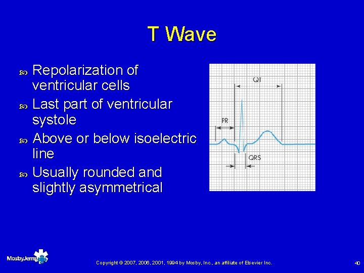T Wave Repolarization of ventricular cells Last part of ventricular systole Above or below