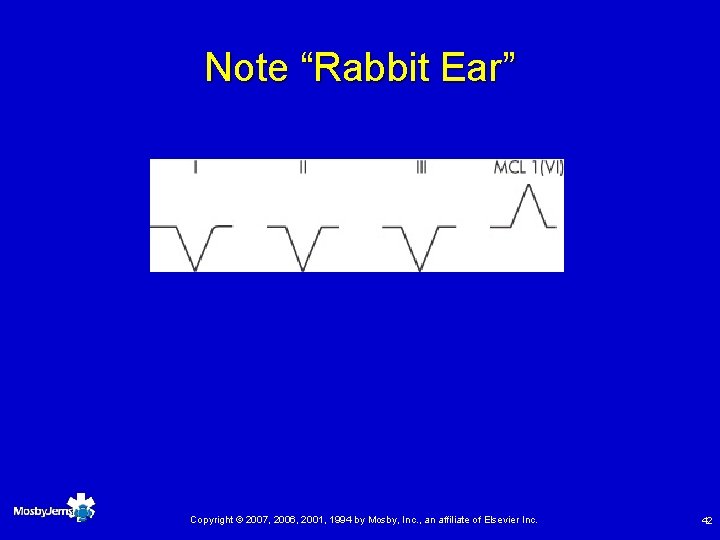Note “Rabbit Ear” Copyright © 2007, 2006, 2001, 1994 by Mosby, Inc. , an