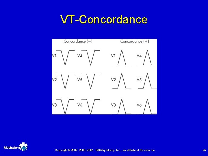 VT-Concordance Copyright © 2007, 2006, 2001, 1994 by Mosby, Inc. , an affiliate of