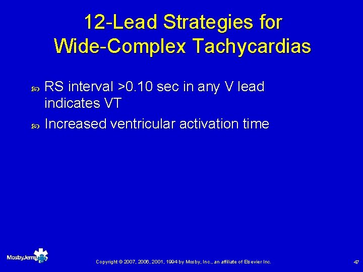 12 -Lead Strategies for Wide-Complex Tachycardias RS interval >0. 10 sec in any V