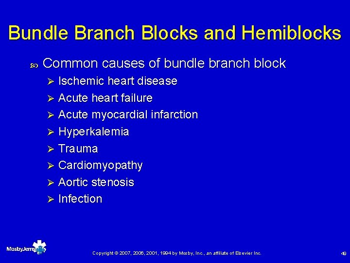 Bundle Branch Blocks and Hemiblocks Common causes of bundle branch block Ischemic heart disease
