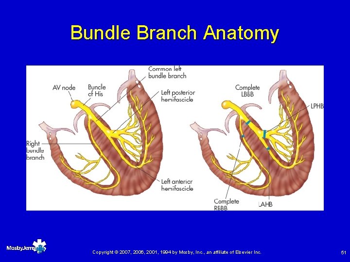 Bundle Branch Anatomy Copyright © 2007, 2006, 2001, 1994 by Mosby, Inc. , an