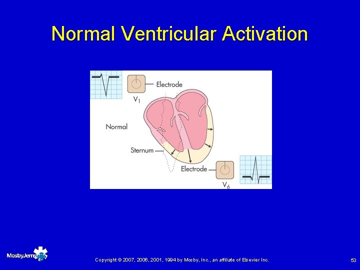Normal Ventricular Activation Copyright © 2007, 2006, 2001, 1994 by Mosby, Inc. , an