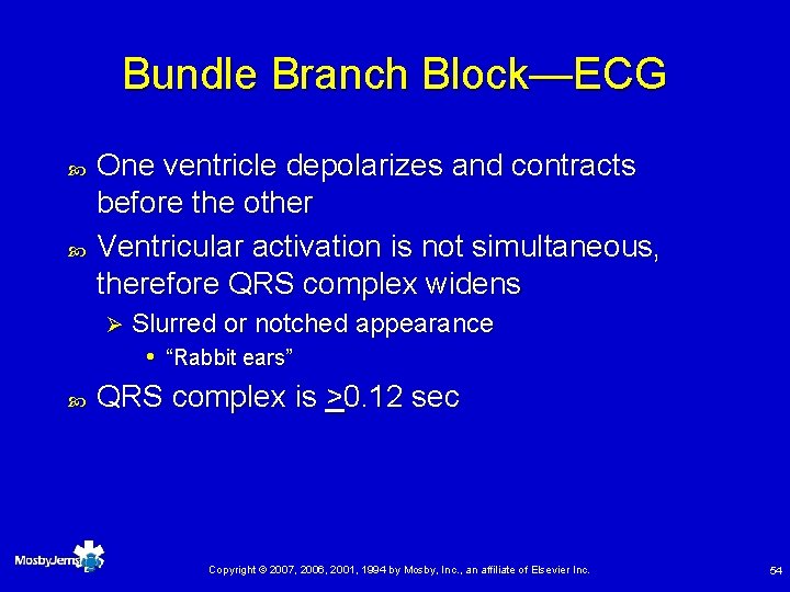 Bundle Branch Block—ECG One ventricle depolarizes and contracts before the other Ventricular activation is