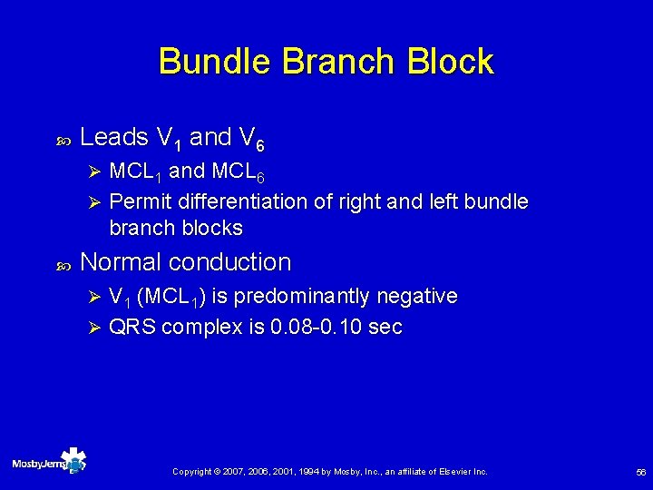 Bundle Branch Block Leads V 1 and V 6 MCL 1 and MCL 6
